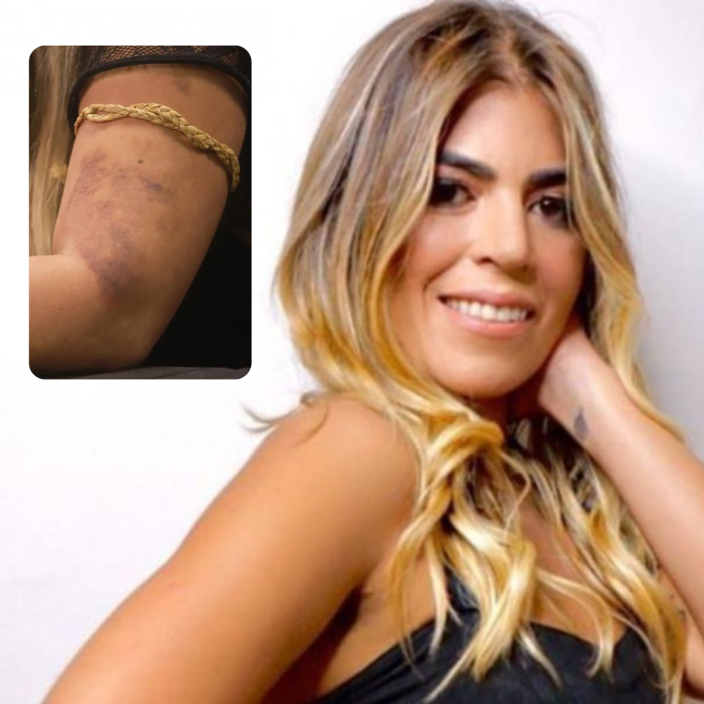 Bruna Surfistinha relata que foi agredida pelo seu ex-marido Xico Santos |  João Alberto Blog